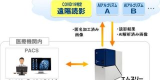 NOBORI、COVID-19遠隔読影と画像診断支援AIシステムを全国100の医療機関に期間限定で無償提供｜innavi net